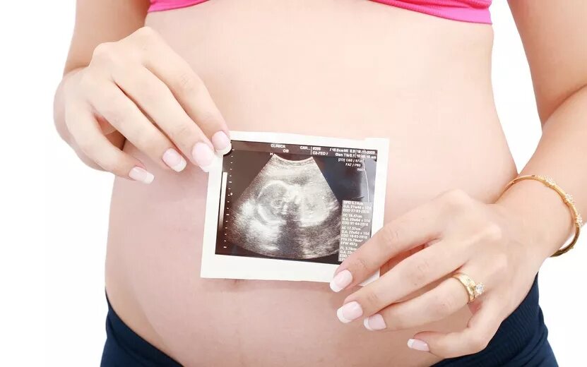    Беременные из Удмуртии смогут получать единое пособие