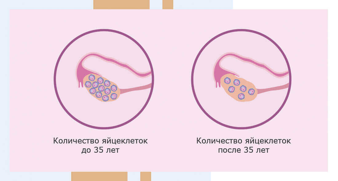Стадии развития фолликула в яичнике. Изменения в яичниках и матке в течение менструального цикла. Схема строения яйцеклетки. Гормон запас яйцеклеток. Низкий овариальный резерв критерии.