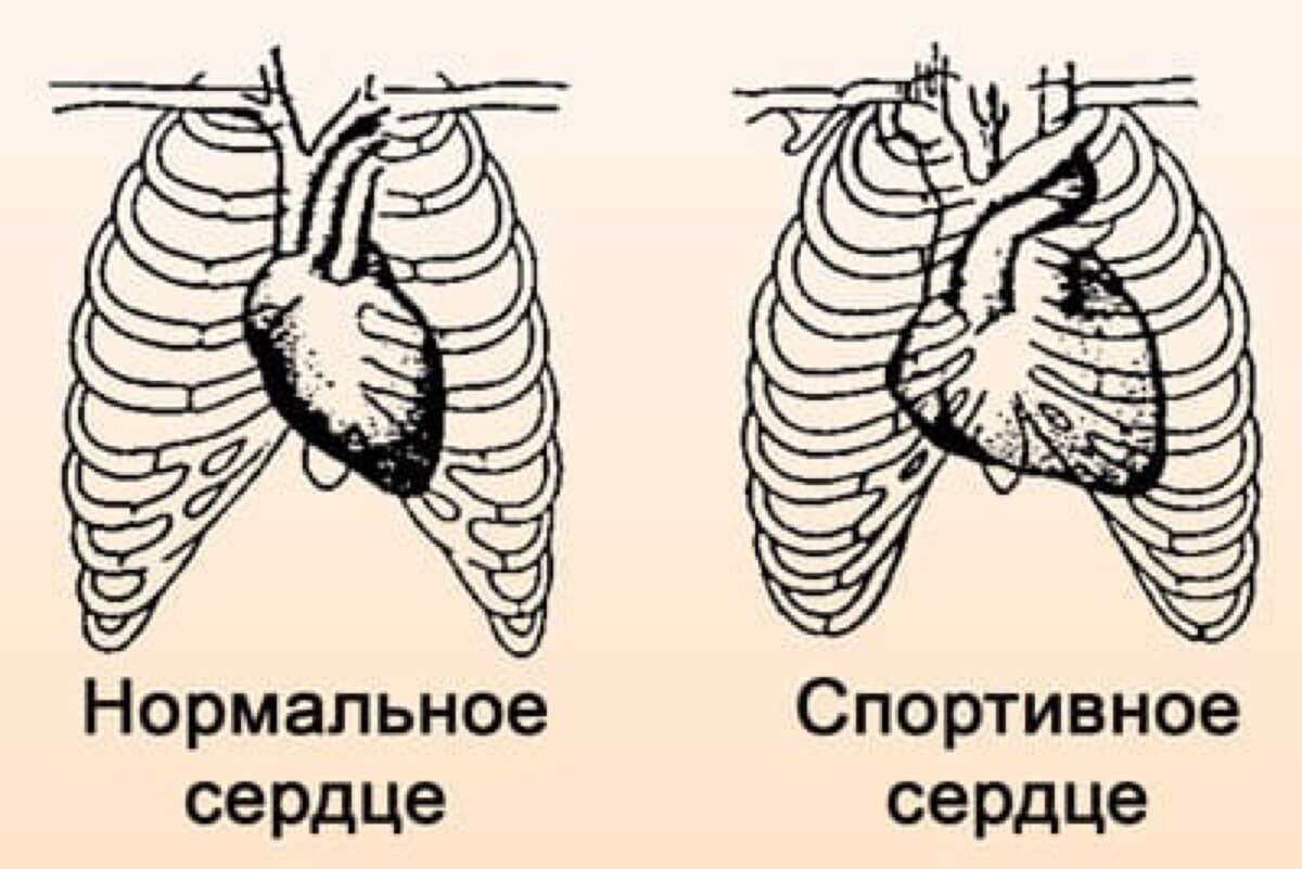 Чем сердце тренированного человека отличается от сердца. Сердце спортсмена и обычного человека. Сердце спортсмена и сердце обычного человека. Легкие спортсмена и обычного человека. Легкие человека тренированного и нет.
