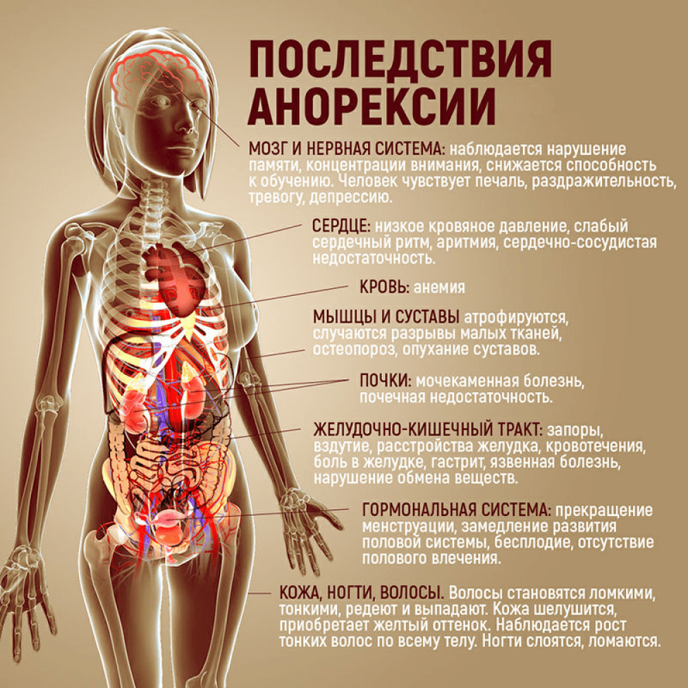 Что происходит организме после. Последствия анорексии. Последствия анорексии для организма.