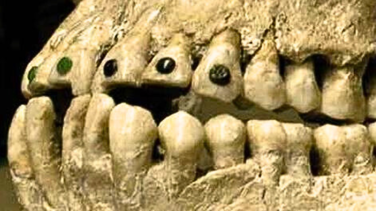 Украшение зубов в древности. Зубные протезы в древности. Индеец зуб