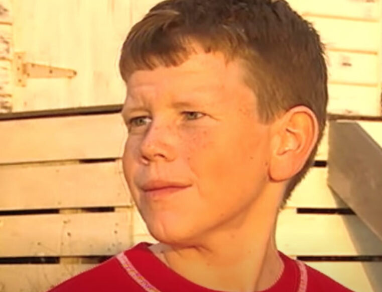 Томм Теннент родился с избыточным количеством кожи. Ее было достаточно, чтобы покрыть тело 5-летнего ребенка.-8