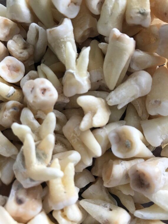 Зубы в платье.