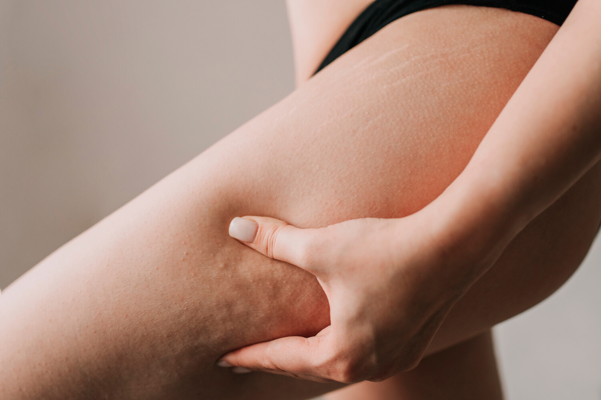 Фото: Shutterstock