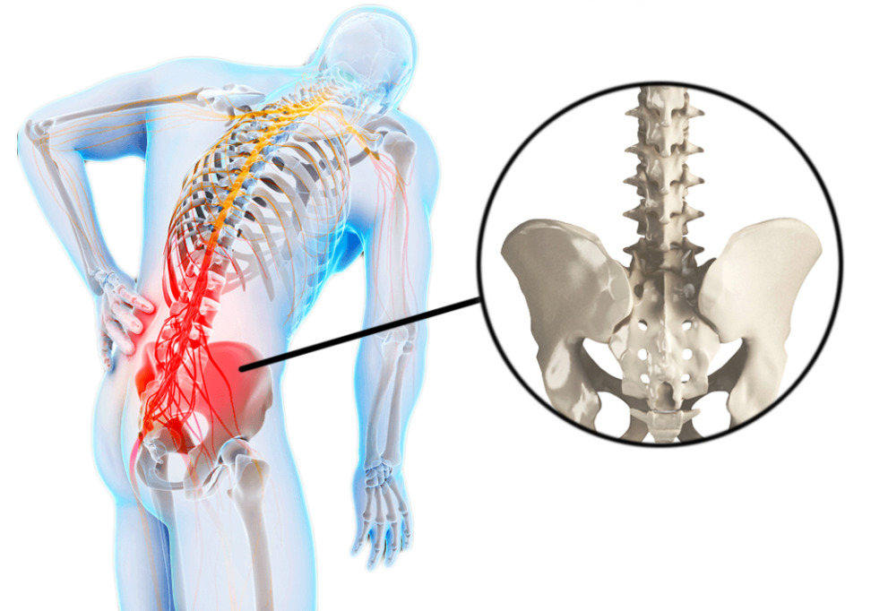 Пояснично-крестцовый отдел позвоночника. Люмбаго поясничного отдела позвоночника симптомы. Поясцово-крестцовый отдел позвоночника. Люмбалгия поясничного крестцового отдела. Поясница причины