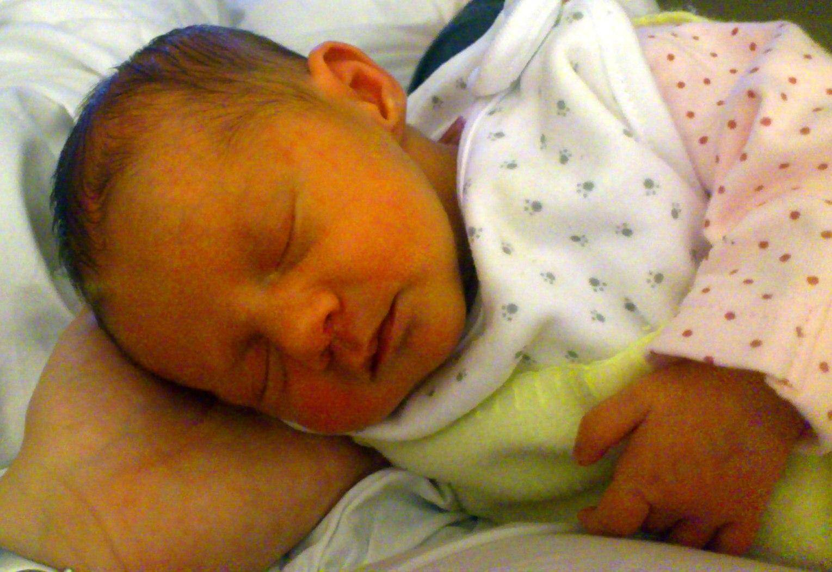 Малыши после месяца. Желтушка у новорожденных. Физиологическая желтушка у новорожденных. Что такое желтушка у новорожденных детей.