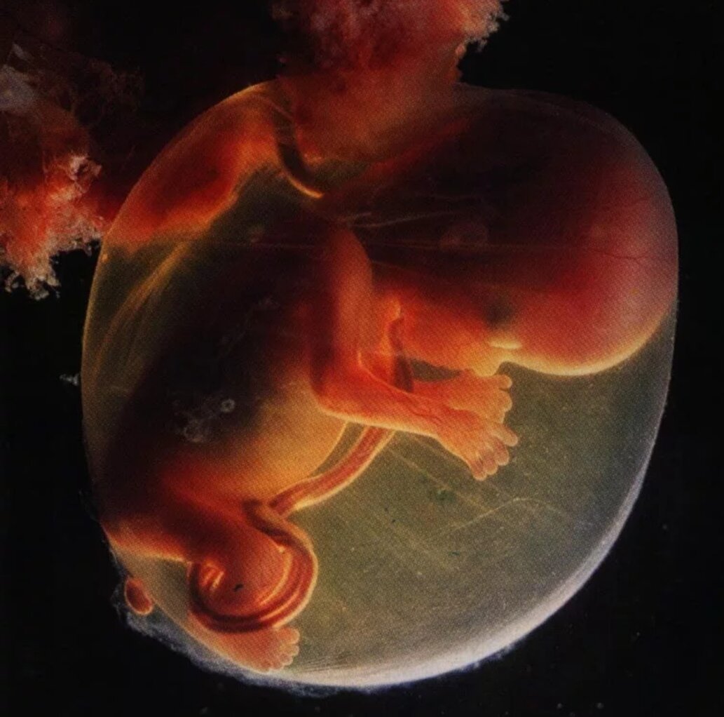 Пятая неделя ребенку. Зародыш человека 16 недель. Эмбрион на 4 месяце беременности. УТ детям.