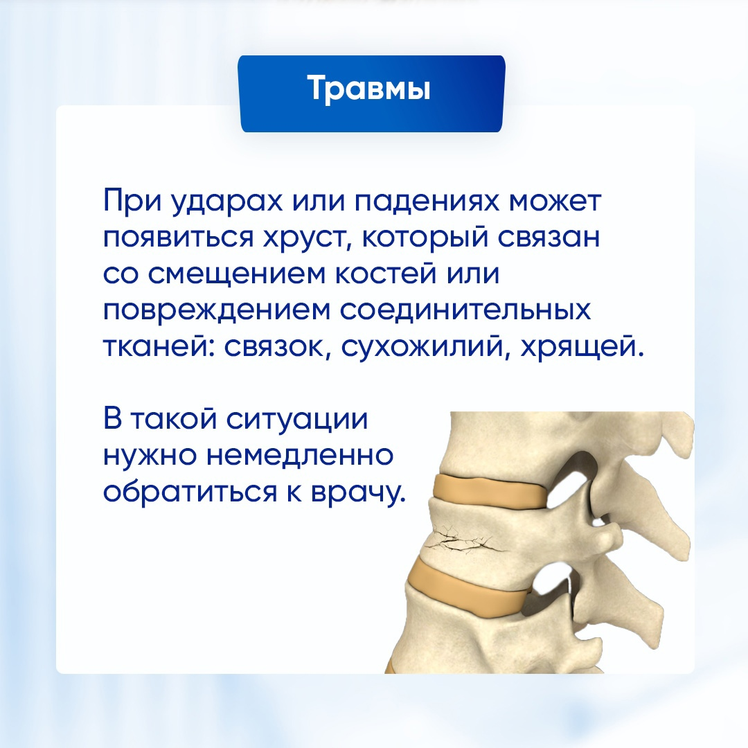 Хруст позвоночника. Причины хруста при повороте головы. Причины хруста при повороте головы. Хрустят позвонки в шее при повороте головы. Хруст в затылке при вращении.