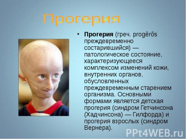 Фото из интернета, сайт optifishing.ru