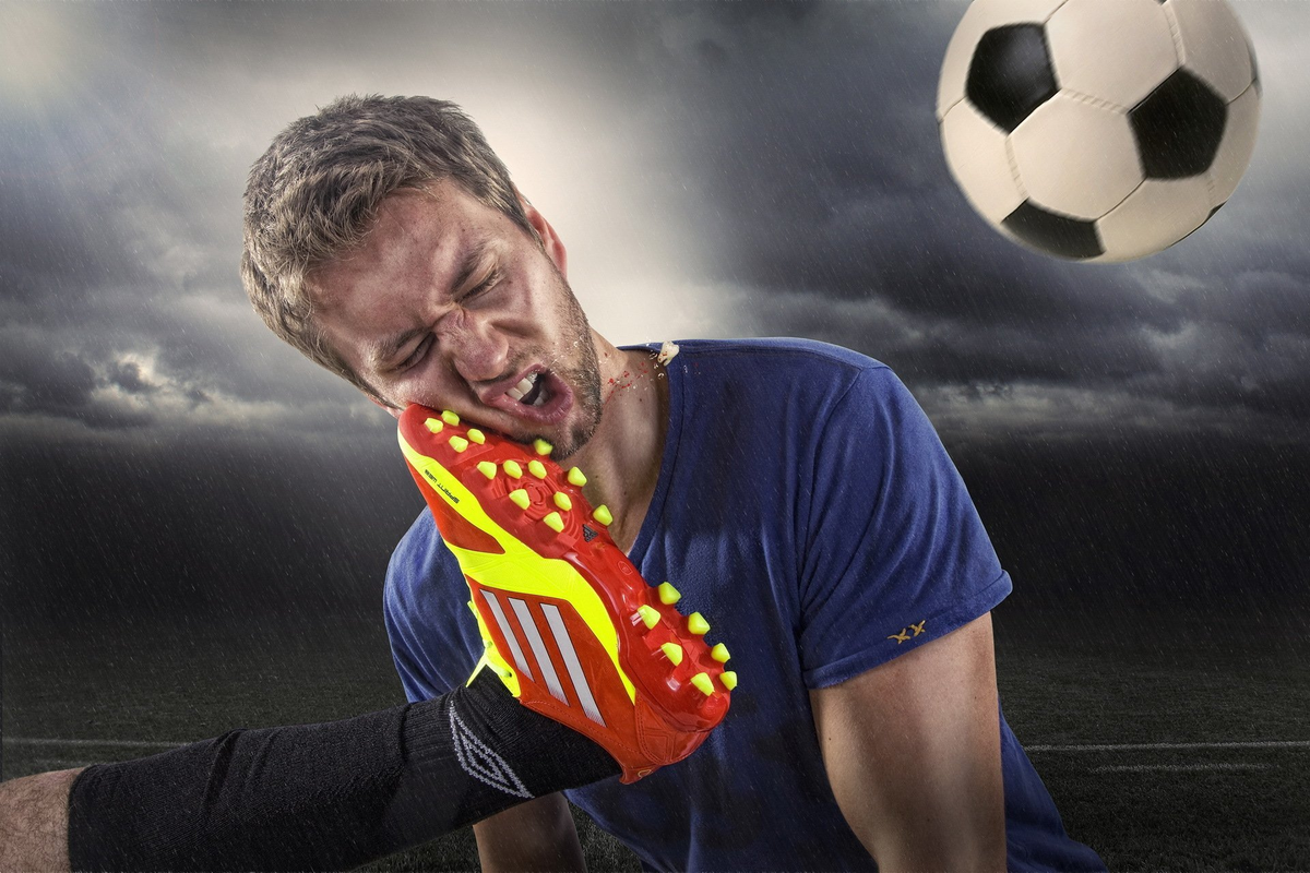      Травмы случаются и в FBM    )))