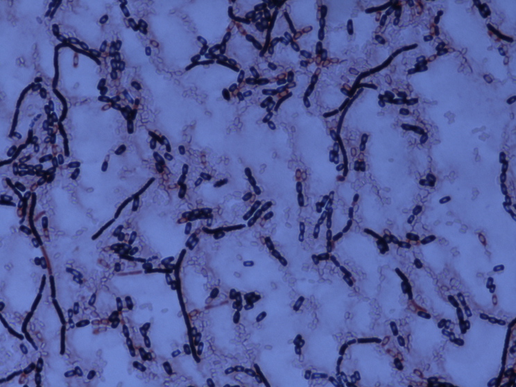 Бактерии, найденные во льдах Антарктиды