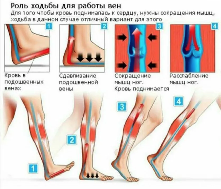 Операция на мышцах ног. Варикозное расширение вен (ВРВ) нижних конечностей. Гимнастика для профилактики варикозного расширения вен. Упражнения для профилактики варикоза. Упражнения от варикозного расширения вен.