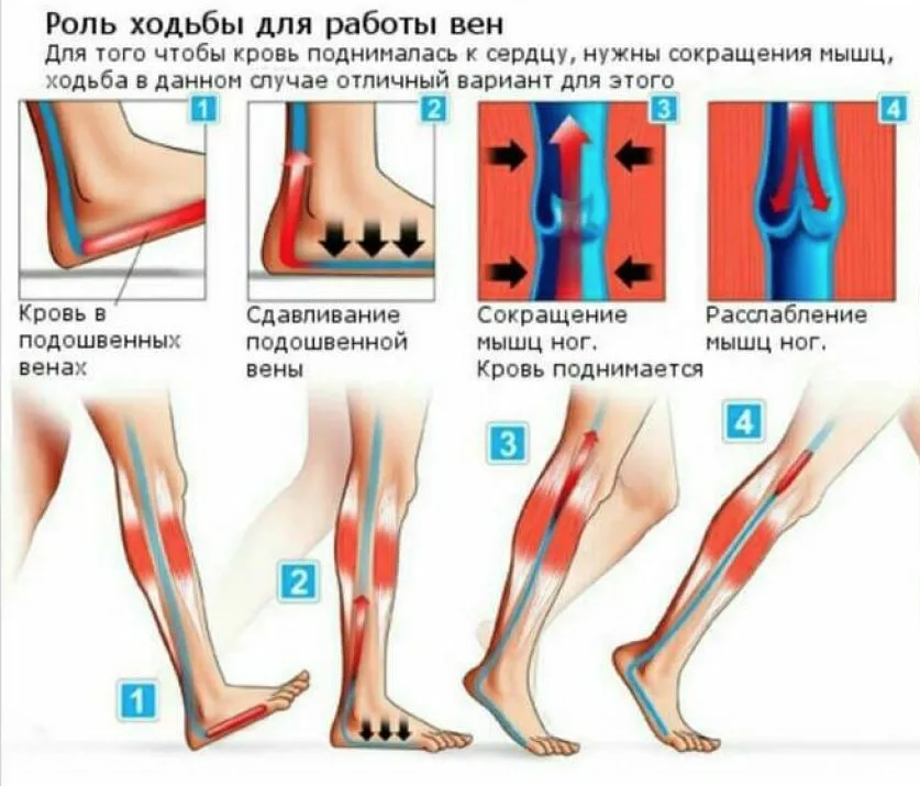 Упражнения при варикозном расширении