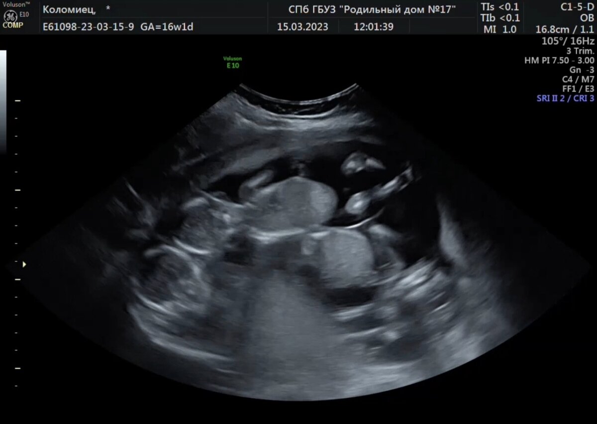 Трое в животе