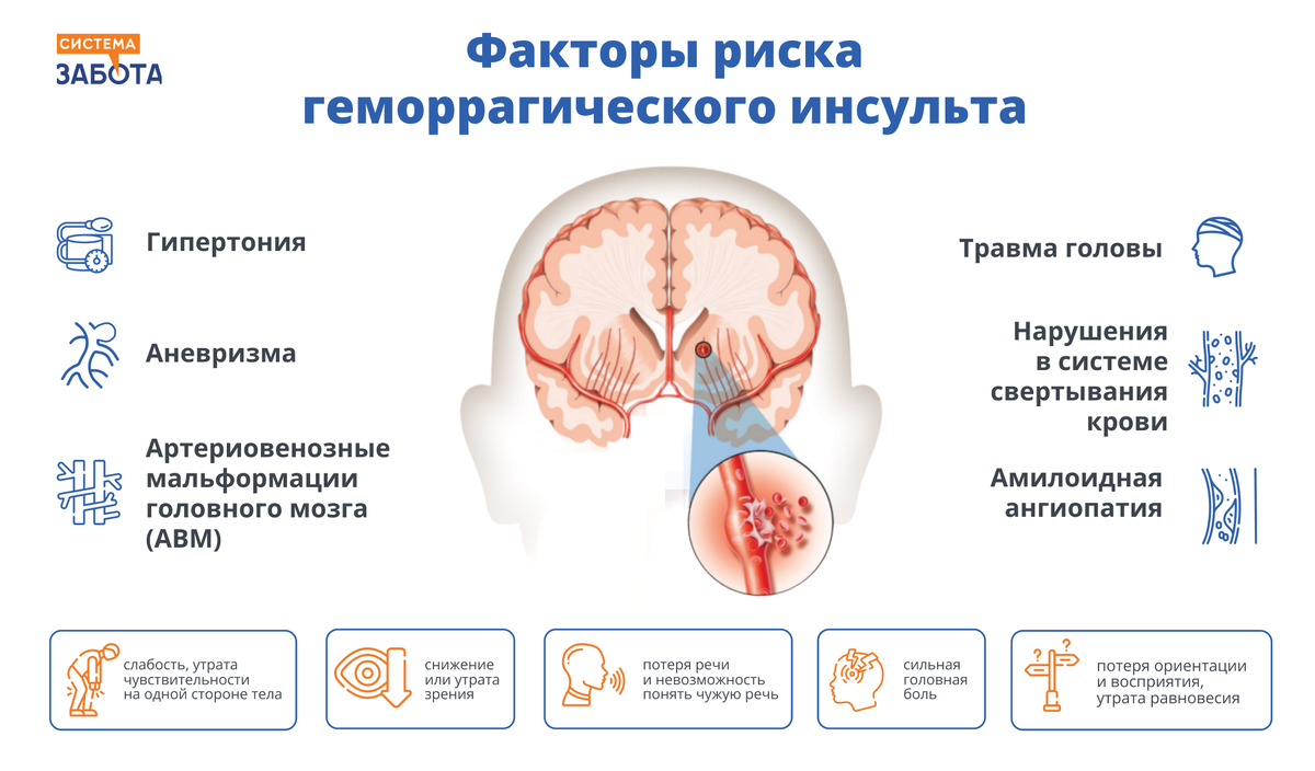 Лечение последствий геморрагического инсульта. Геморрагический инсульт. Риск геморрагического инсульта. Инсульт инфографика. Патогенез геморрагического инсульта.