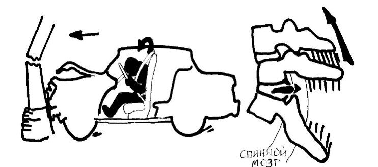 столкновение - препятствие спереди, передний удар