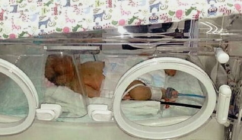 Малышка в больнице