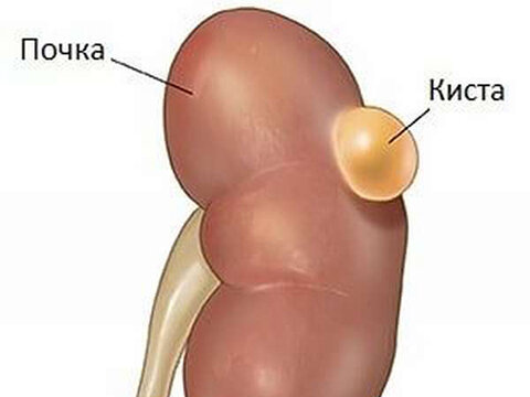 После секса болят почки