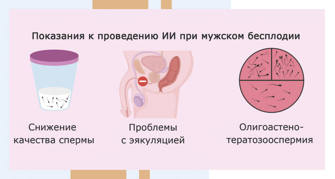 Искусственная инсеминация