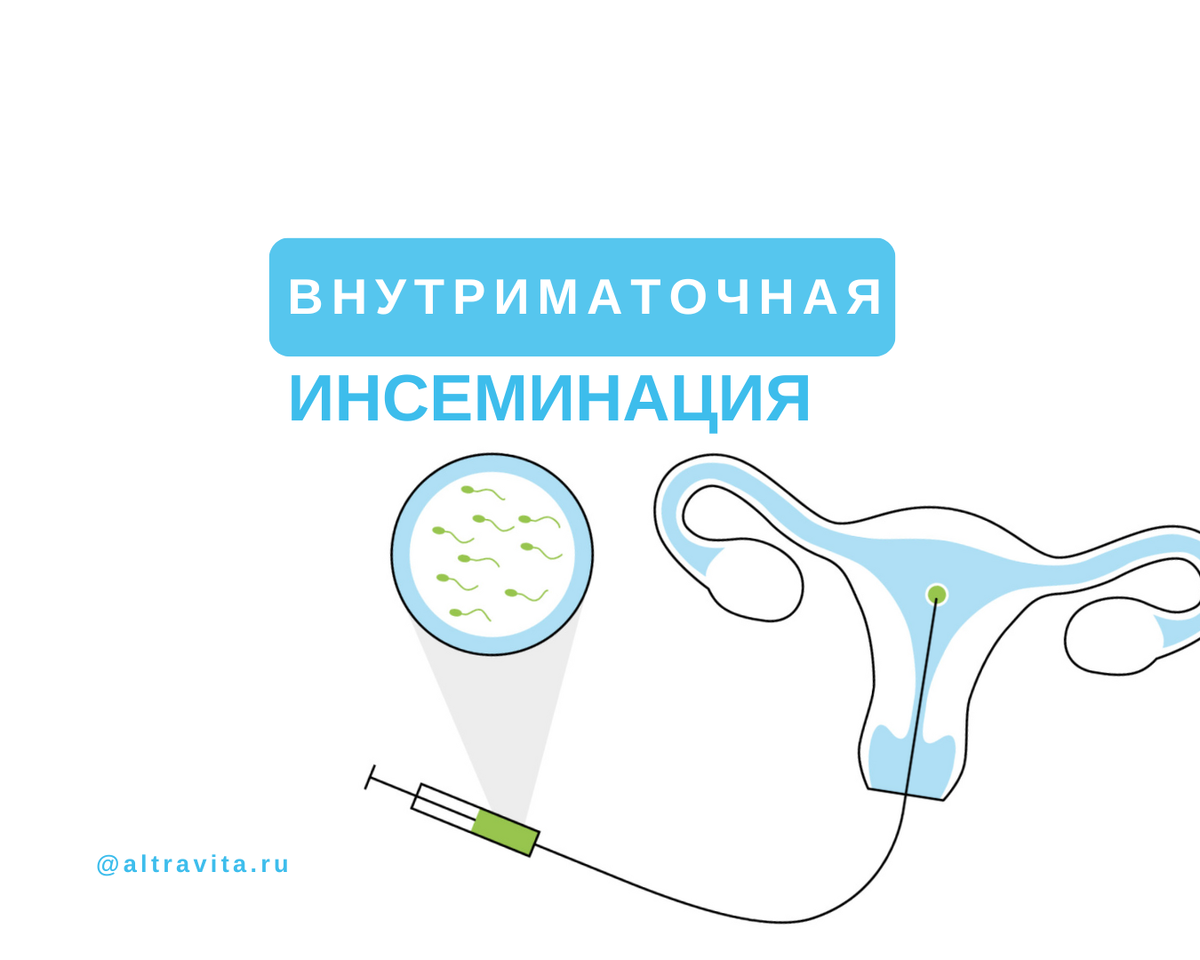 Инсеминация