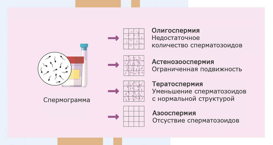 Спермограмма | Клиника «АльтраВита» | Дзен