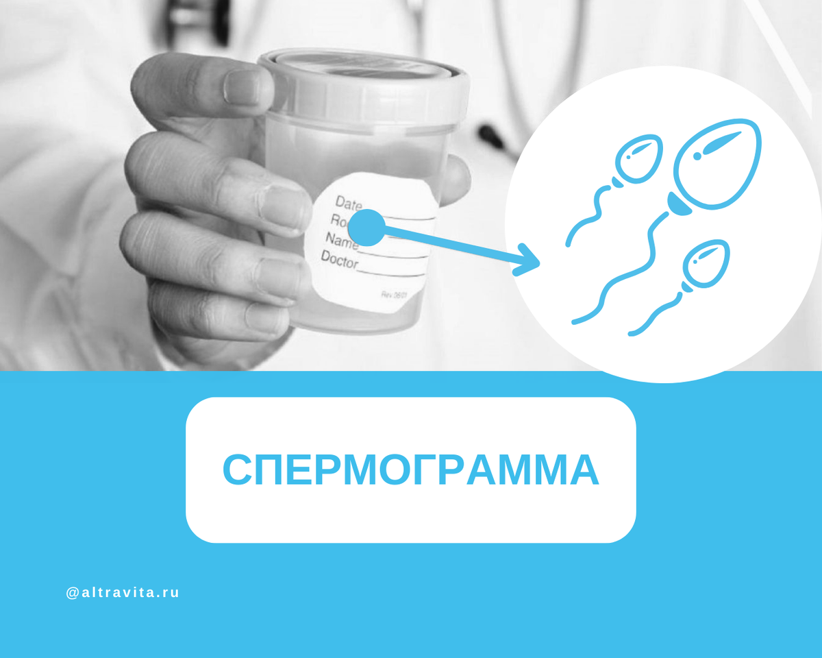 Исследование спермы (спермограмма) в клинике Геном в Волгограде