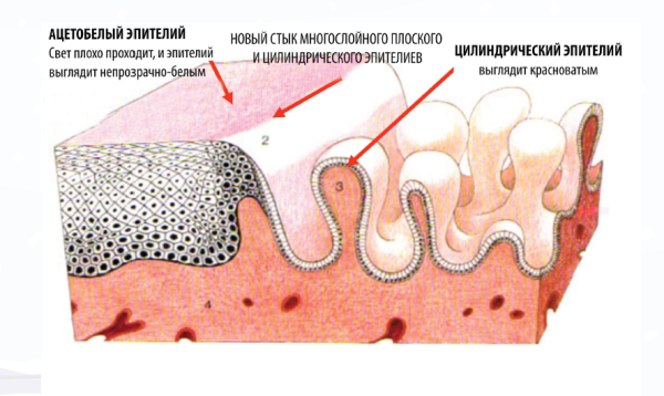 ЖЕНСКАЯ ПОЛОВАЯ СИСТЕМА