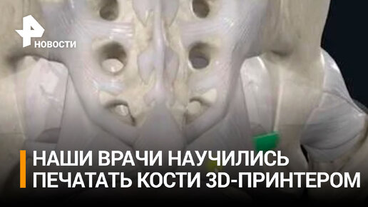 Российские ученые научились воссоздавать на 3D-принтере любые кости человека