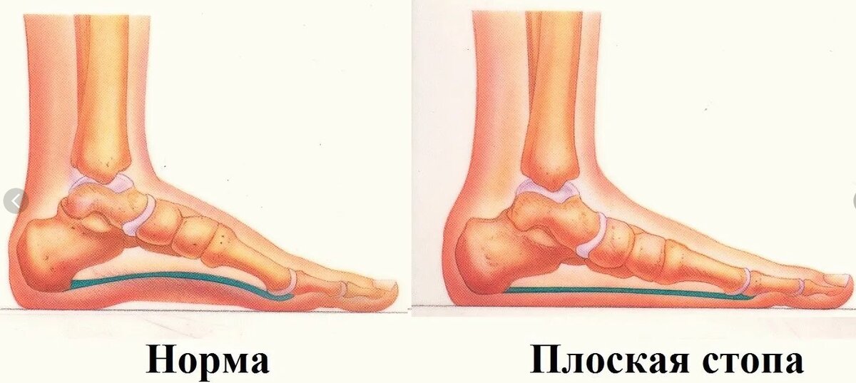 Почему болят суставы и что при этом нужно делать - сосудистая клиника на Патриарших