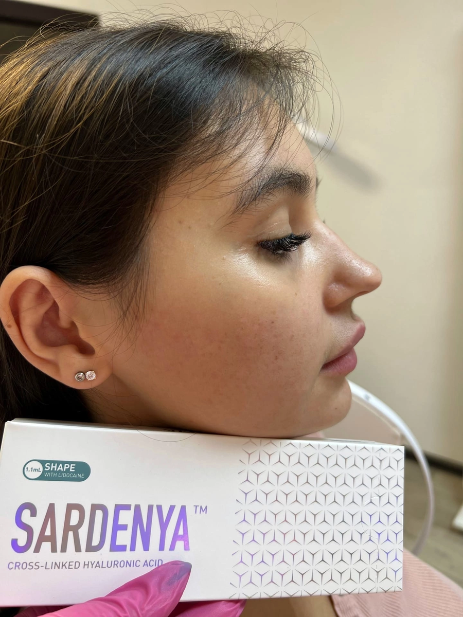 Фото до процедуры 