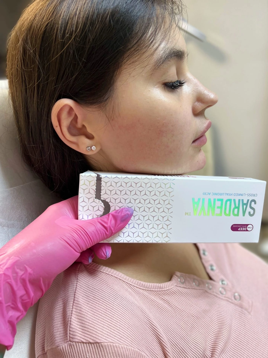 Фото после процедуры