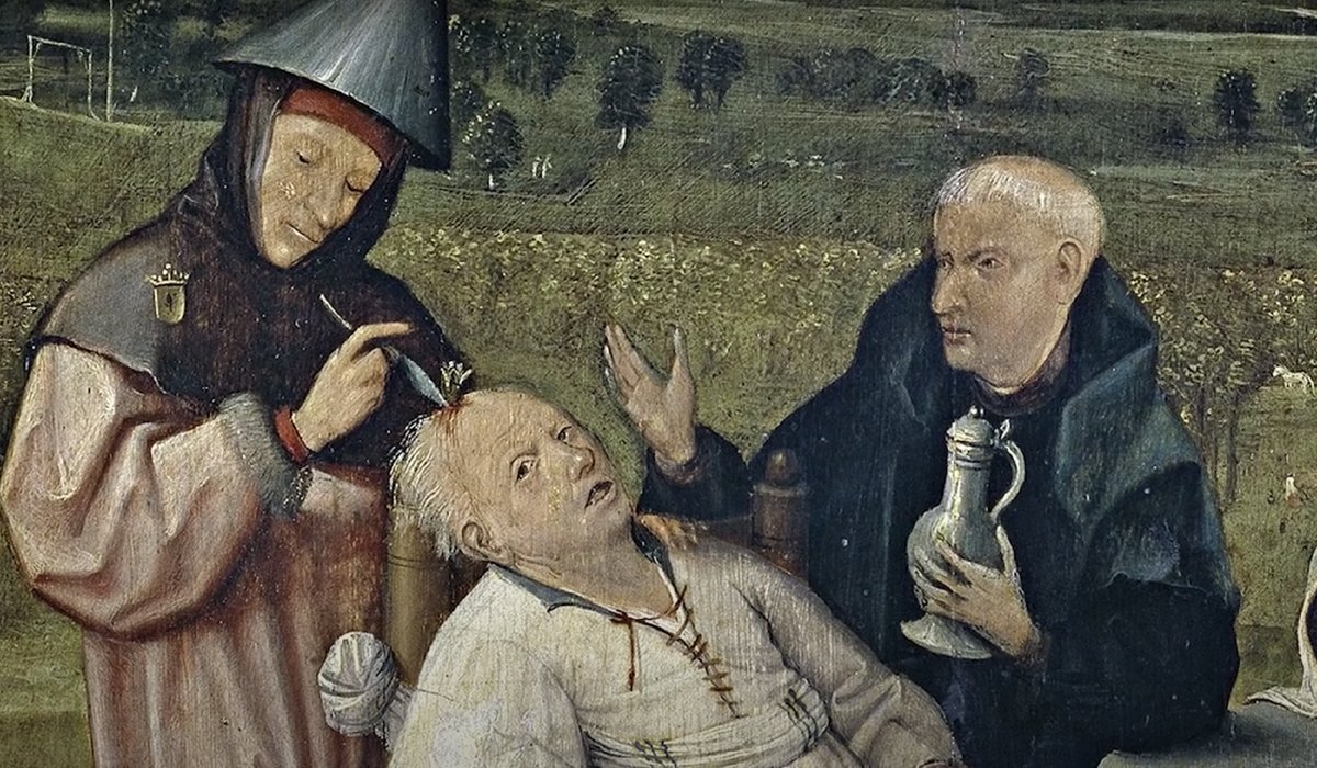 Средневековый врач делает трепанацию методом выскабливания