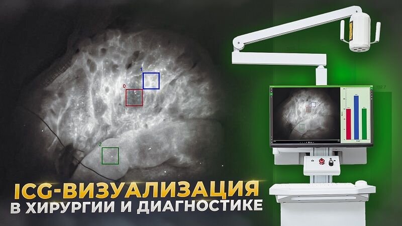 Молекулярная визуализация, основанная на флуоресценции в ближней инфракрасной области (NIRF), имеет огромный потенциал в качестве нового метода медицинского обследования в месте оказания медицинской помощи. Поручикова О.Л., Грачев П.В.
