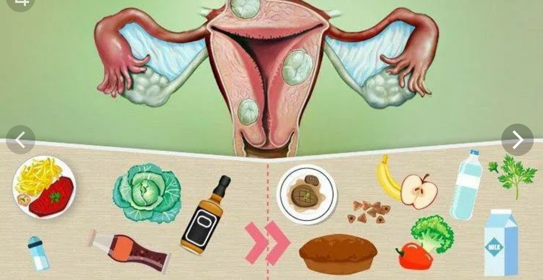 Что кушать после удаления матки. Продукты питания при менструации. Продукты полезные для матки. Продукты питания при миоме матки. Полезные продукты для яичников и матки.