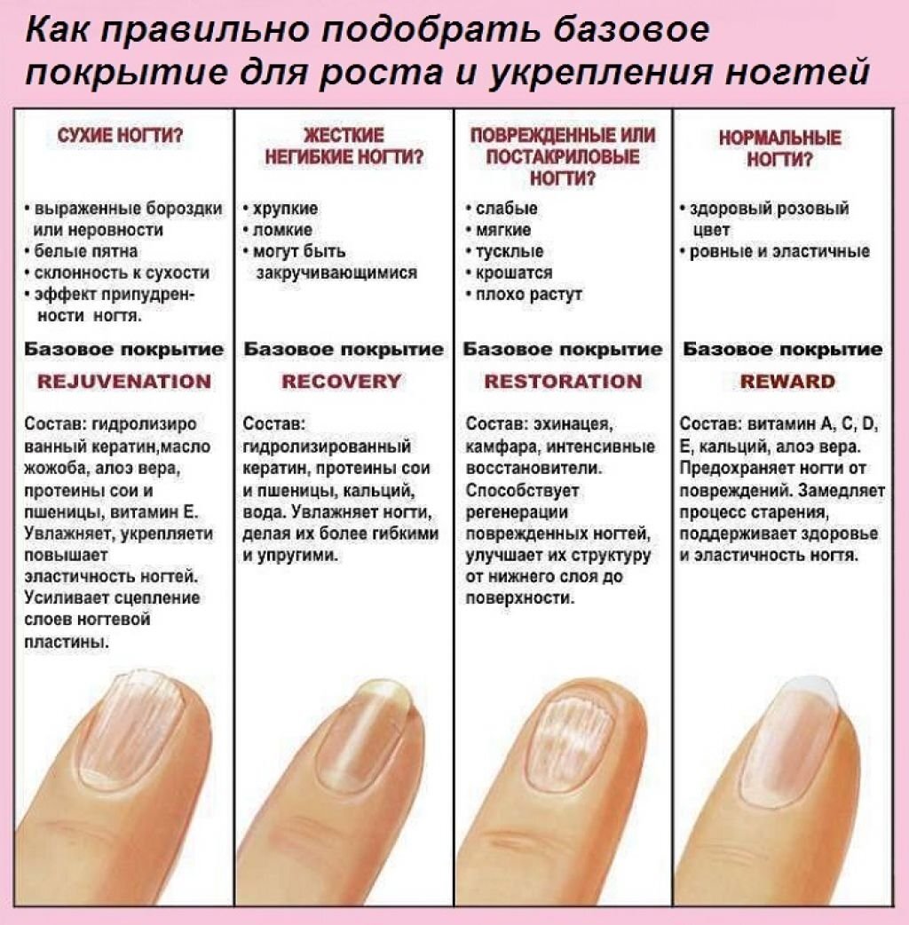 Почему нужны ногти. Выявление болезни по ногтям. Болезни по ногтям на руках таблица. Определить заболевание по ногтям. Распознавание болезни по ногтям.