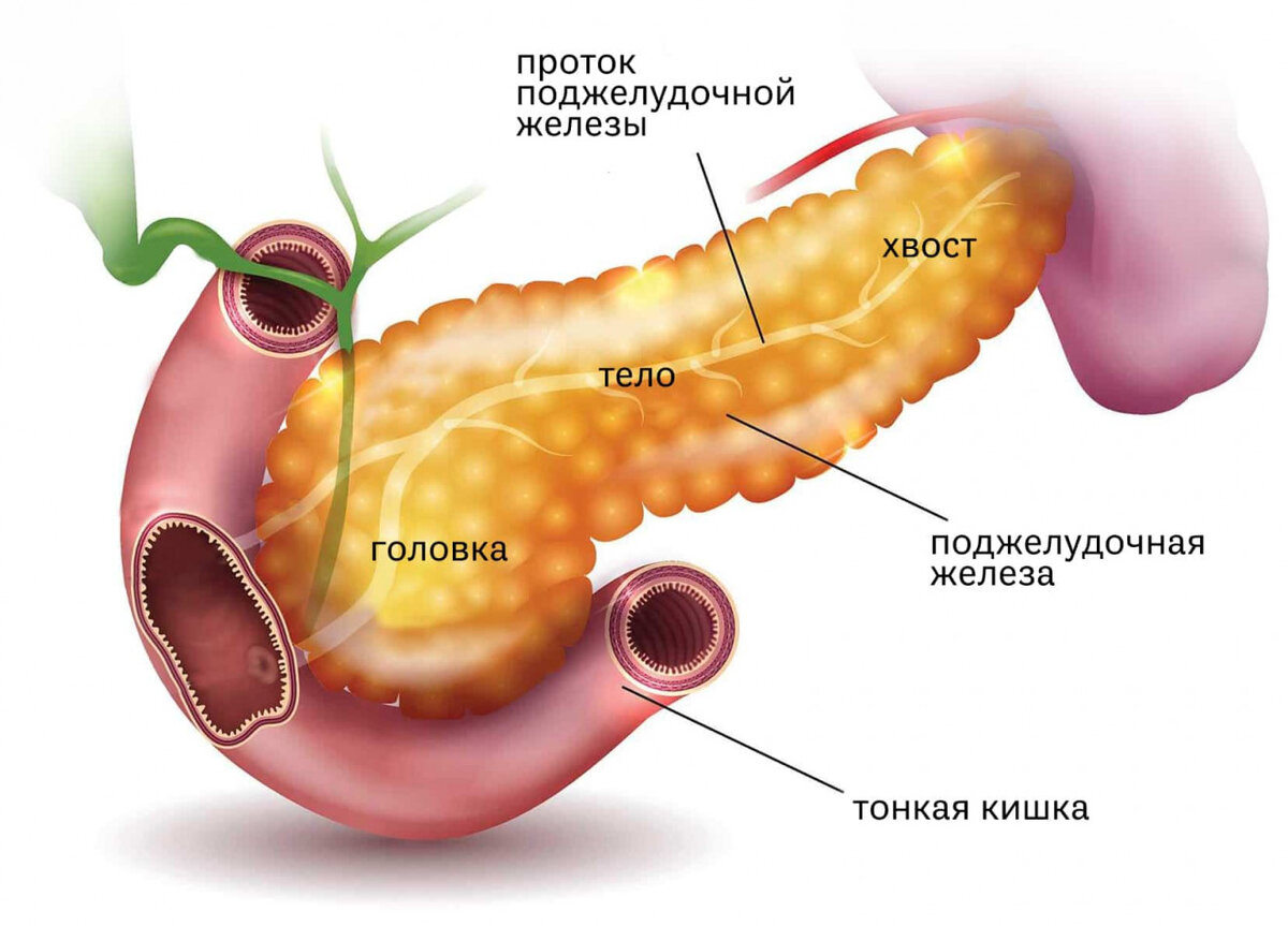 Острый панкреатит рисунки