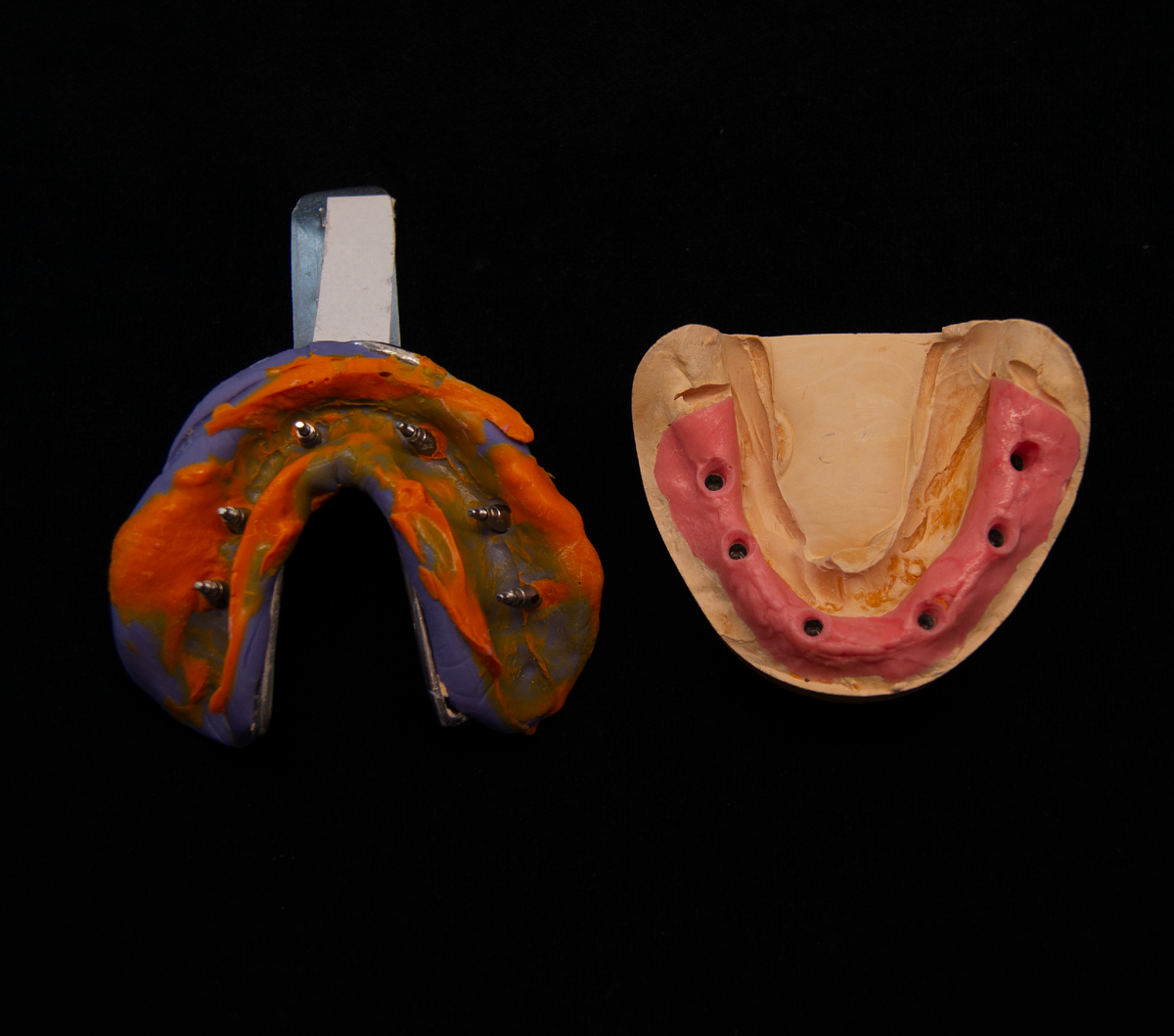 Первоначальный слепок нижней челюсти пациента с трансферами (служат для точной передачи на рабочую гипсовую модель позиции имплантата в полости рта).
И изготовленная первичная модель, для подготовки трансфер-чеков и индивидуальной ложки.