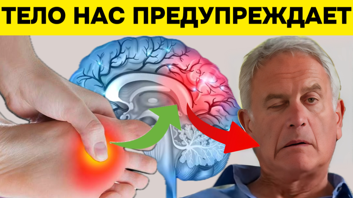 Stroke c. Первые признаки инсульта у женщины симптомы.