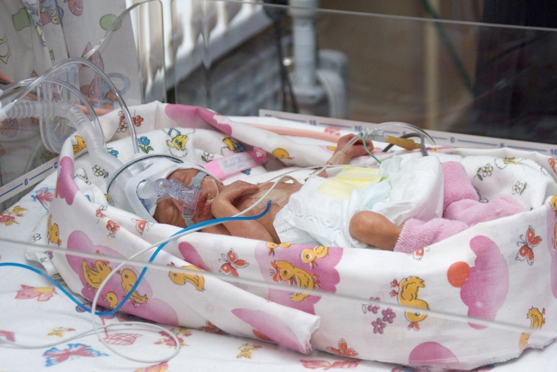 Недоношенный малыш в "гнезде" на аппарате неинвазивной вентиляции лёгких. 