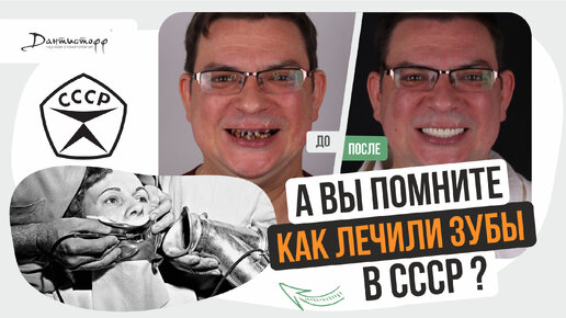 Вы помните КАК лечили зубы в СССР ? → #имплантациязубов #зубныепротезы