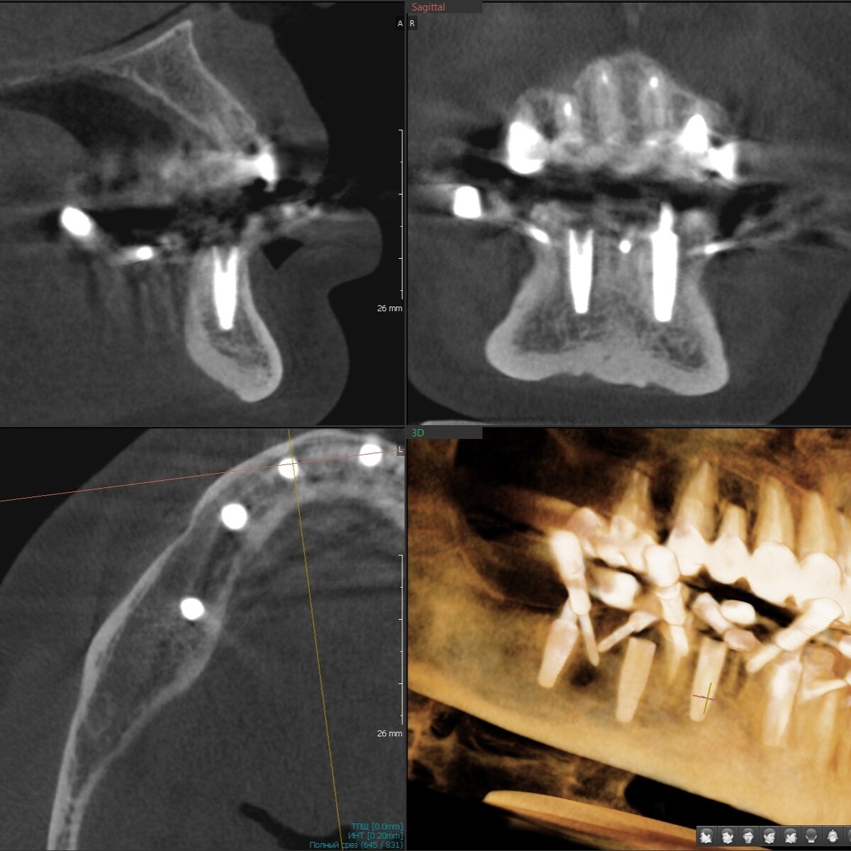 Всё на 6-ти. Печальная история одной подковы, решившей судьбу зубов ...