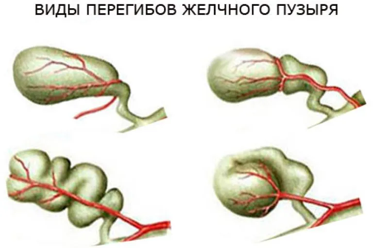 Лечение болезней желчного пузыря, поджелудочной железы