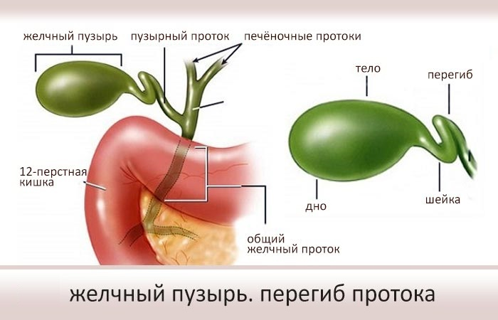 Желчь у новорожденного. Перегиб протока желчного пузыря. Перегиб желчного пузыря и норма. Человек с перегибом желчного пузыря.