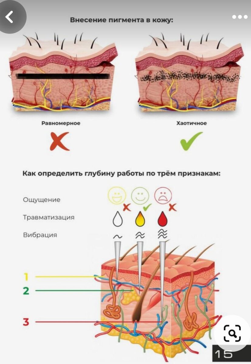 Вопросы ответы по удалению татуировок