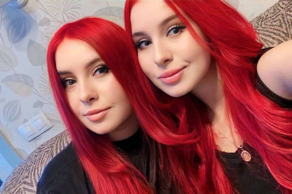    Девушки с детства страдают от редкой деформации ног. Фото: из личного архива героев публикации