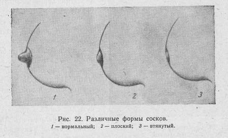 Втянутые соски у женщин: причины и что делать?