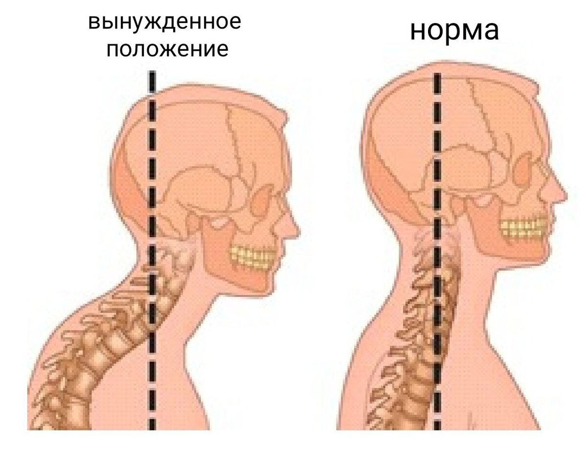 Легкая спина москва