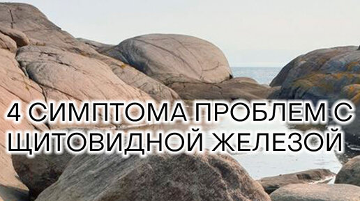 Эндокринолог Мария Мостовая | 4 симптома проблем с щитовидной железой ...