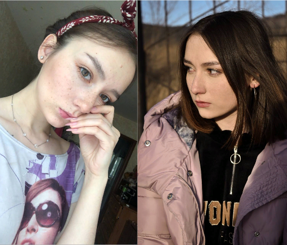 Лицо моей дочери с веснушками и без