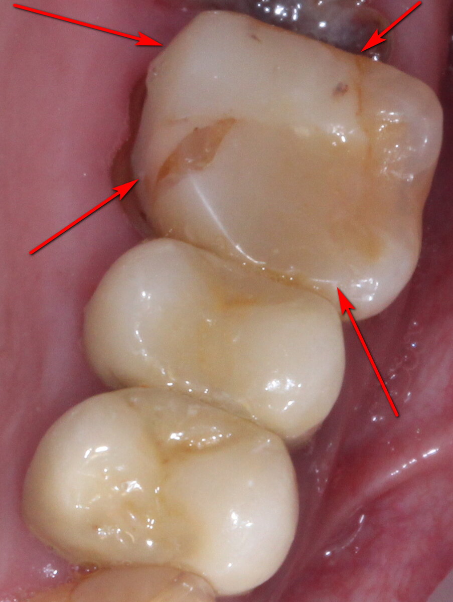 На фото типичная «залепуха» из светового композита.